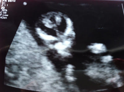 Baby O - Boy or Girl?