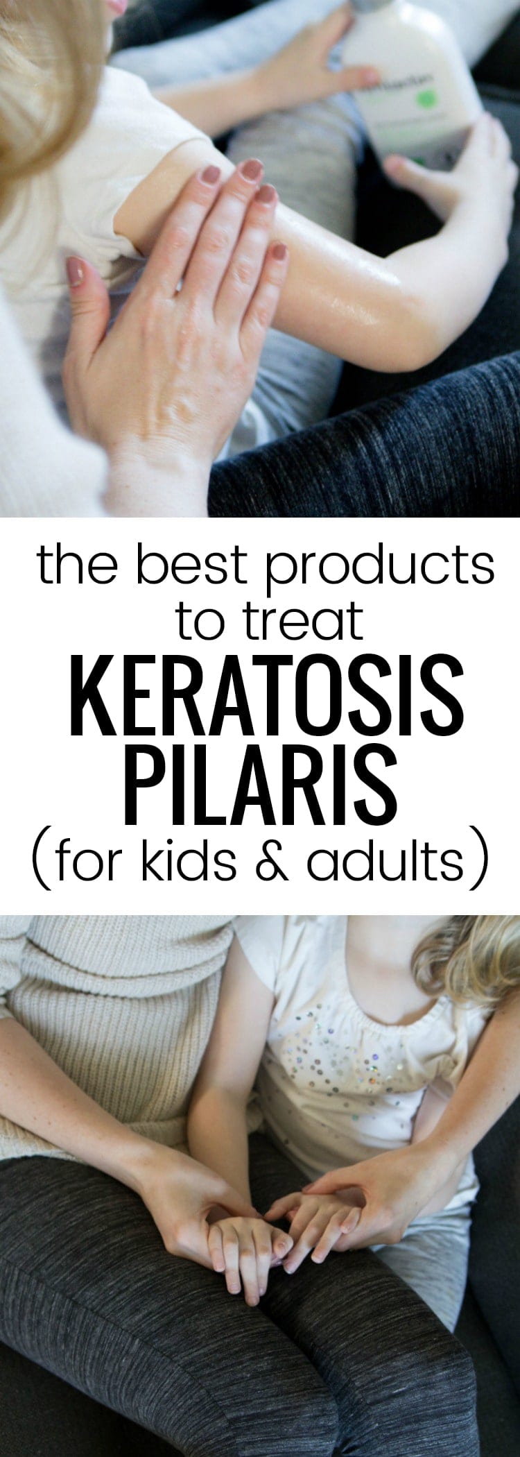 AmLactin products are amazing for treating keratosis pilaris in adults and children! #ad